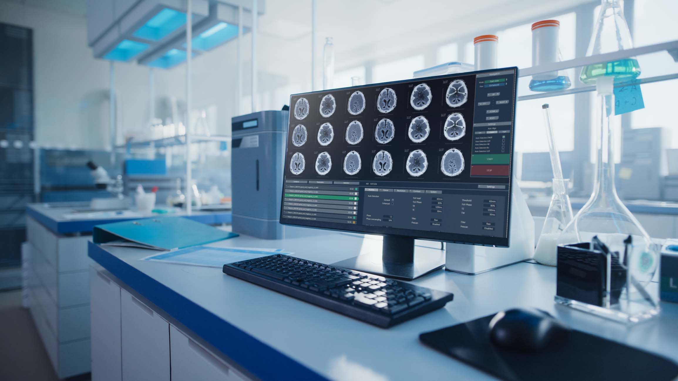 Modern Medical Research Laboratory with Computer Showing MRI Brain Scans. Glassware with Biochemicals on the Desk. Scientific Lab Biotechnology Development Center Full of High-Tech Equipment.