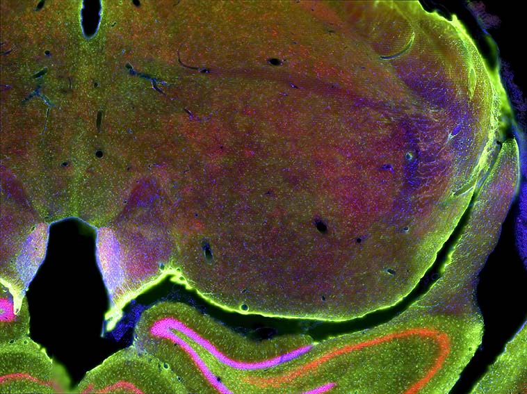 fluorescence view of rat brain slice