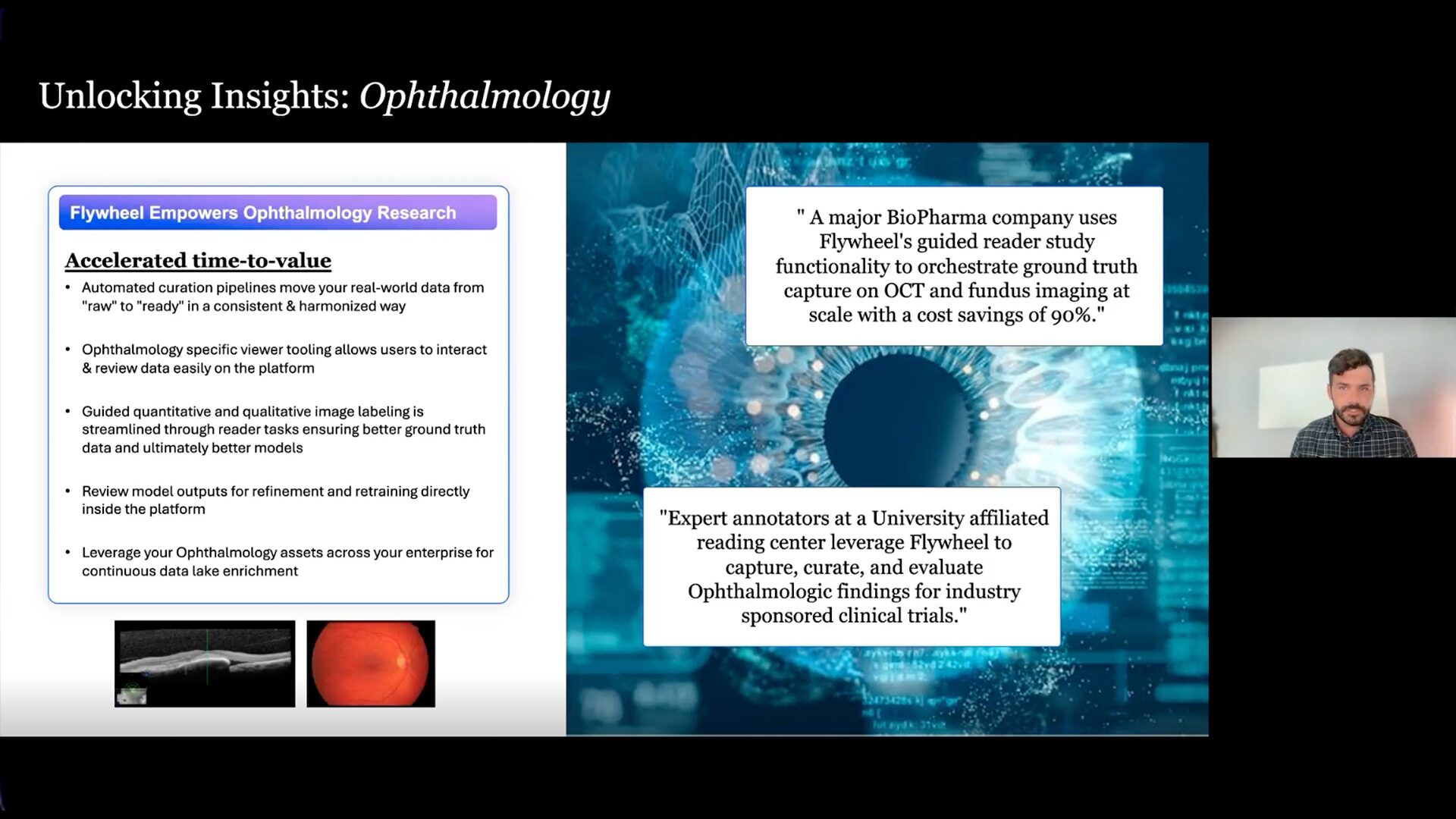 Flywheel ophthalmology webinar