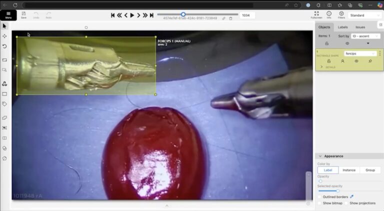 Manage Medical Video Data With CVAT Integration