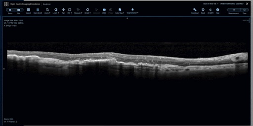 Flywheel Optimizes Optical Coherence Tomography Research with Robust Array of Features
