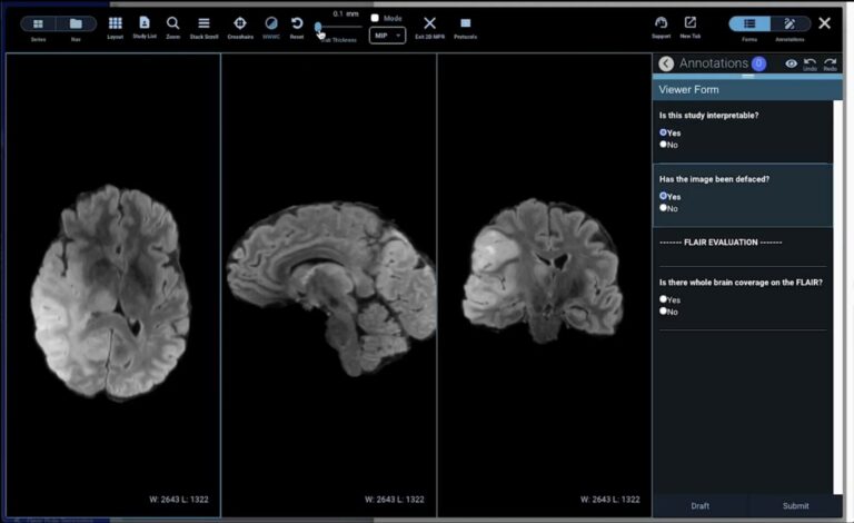 Flywheel for Oncology