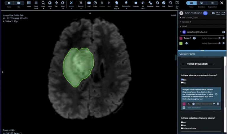 Flywheel Demo: Data Curation
