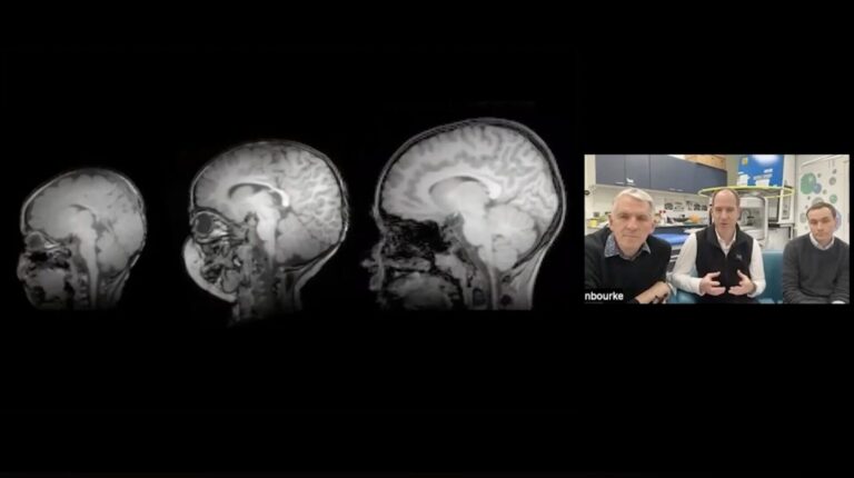 Enabling Brain Imaging Research Across the World: A Project Funded by the Gates Foundation