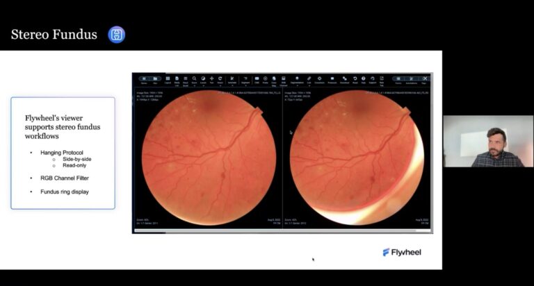 Webinar: Streamline Ophthalmology Imaging Data – Scalable Management & Analysis with Flywheel