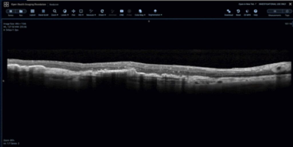 Flywheel Optimizes Optical Coherence Tomography Research with Robust Array of Features