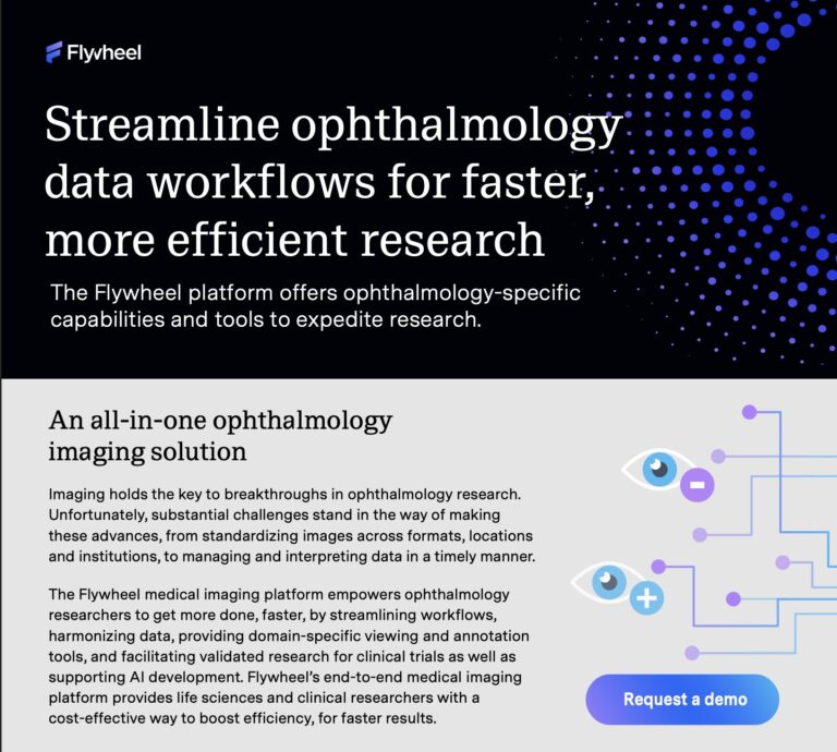 Flywheel for Ophthalmology