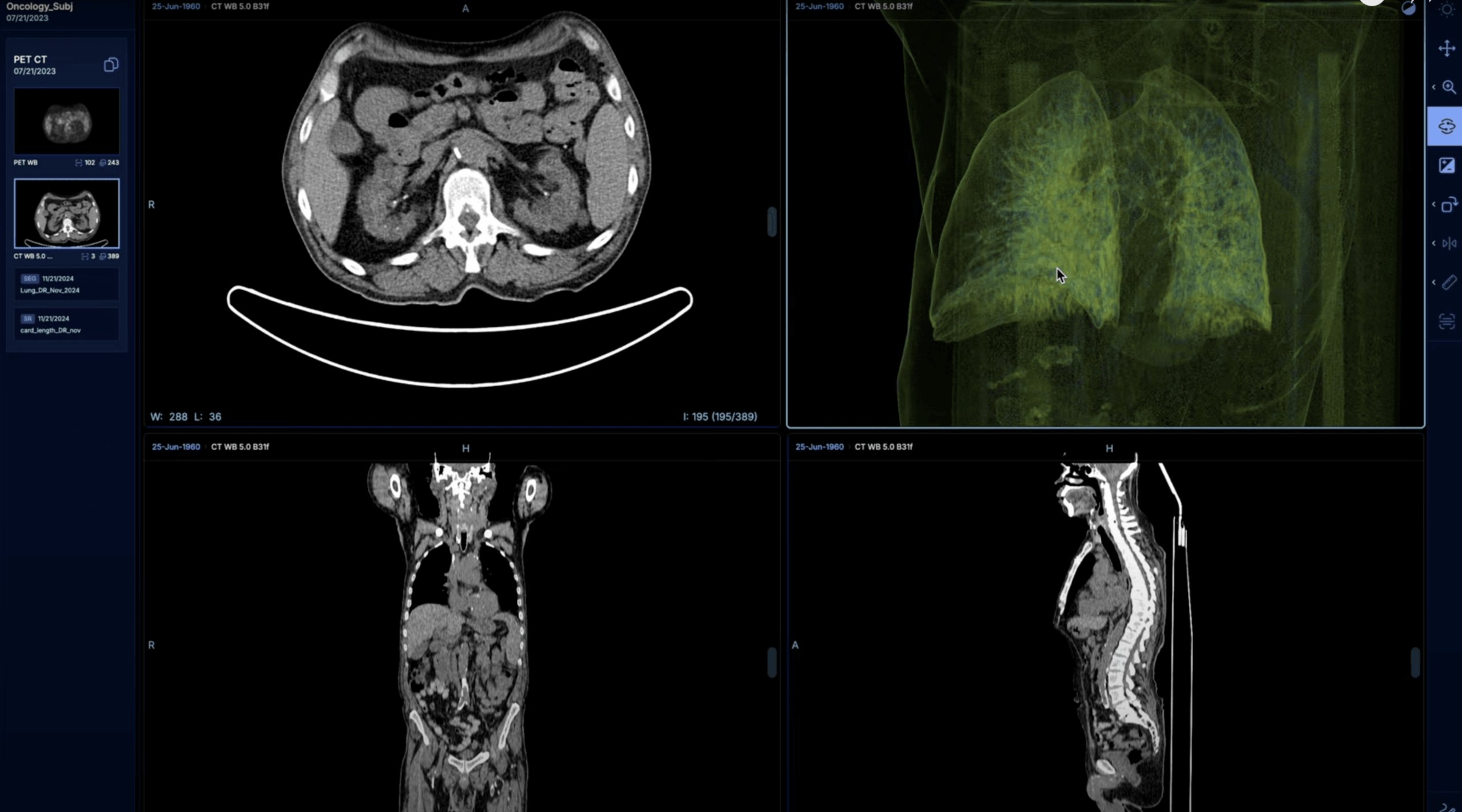 The ability to display a 3D reconstruction of a lung image is shown.
